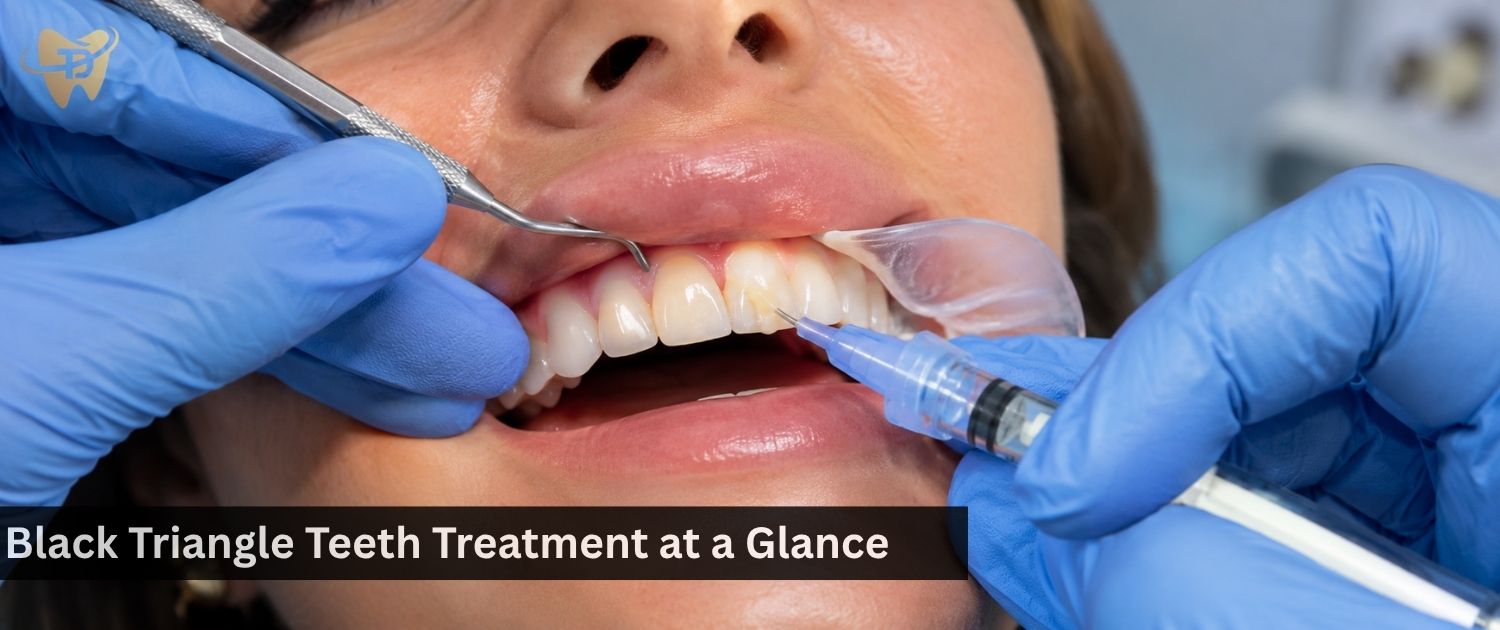 black triangle teeth treatment at a glance in dha lahore