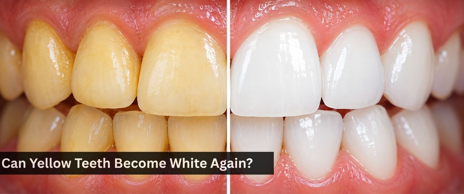 can yellow teeth become white in dha lahore