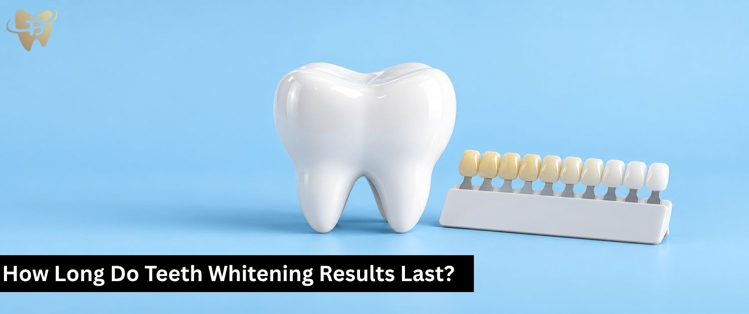 teeth whitening results